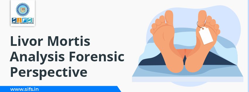 Livor Mortis Analysis Forensic Perspective